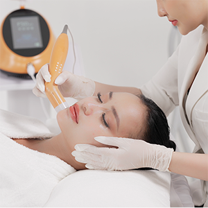Khắc phụ da Nám